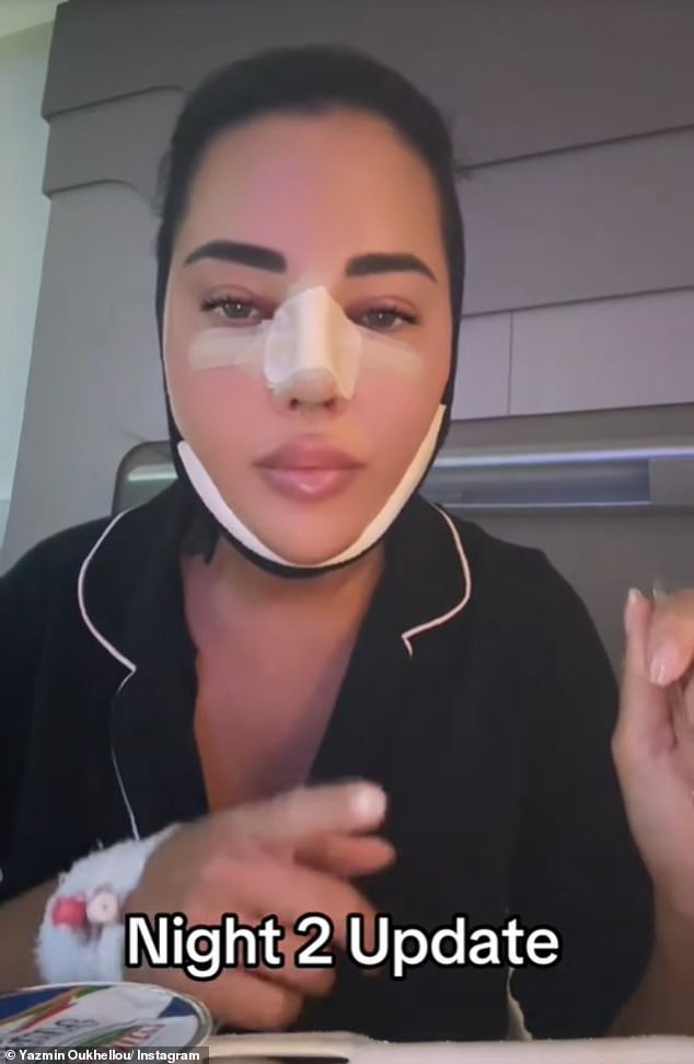 Yazmin Oukhellou showed off her 'sore' and 'swollen' face on TikTok as she recovered from her latest cosmetic surgery in Turkey on Tuesday