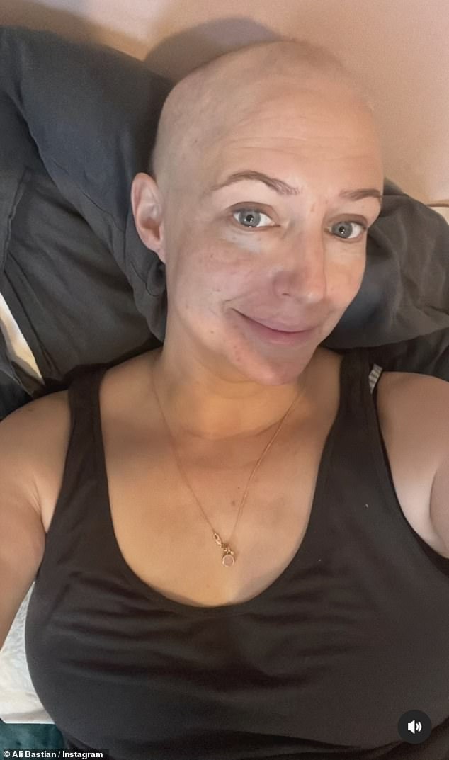 Former Hollyoaks star Ali Bastian has opened up about losing her hair in a candid interview amid her breast cancer battle